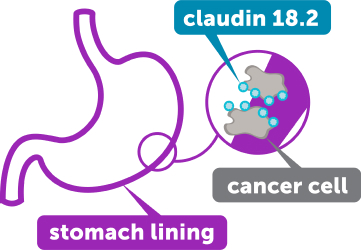 Claudin 18.2 on a Cancer Cell