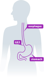 Esophagus, GEJ, and stomach within the human body